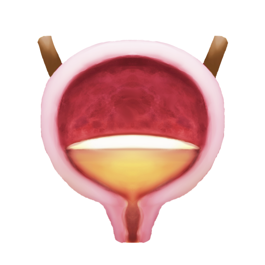 Proposed bladder emoji: An anterior cross-sectional view of the human urinary bladder, partially filled with urine, as well as the proximal urethra and two distal ureters, colored pale red and pale yellow.